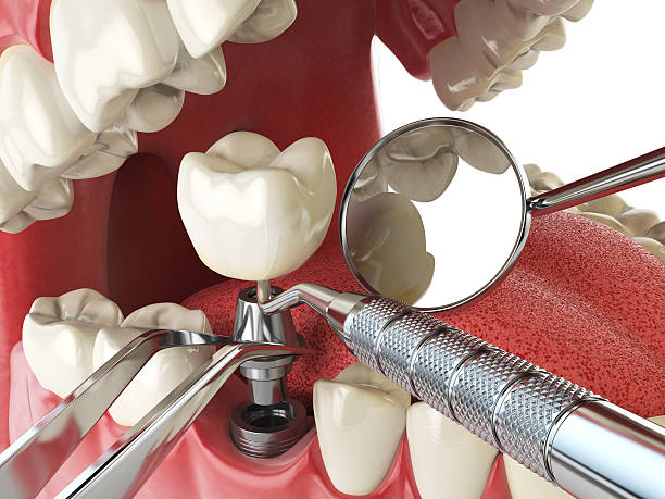 Best Cosmetic Emergency Dentistry in Spring Valley, NV